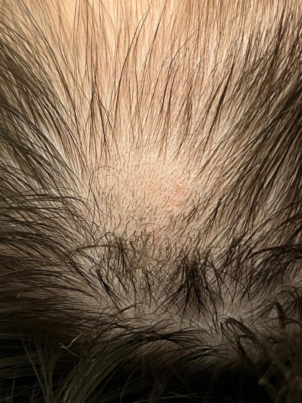 幸好未有傷及髮根。